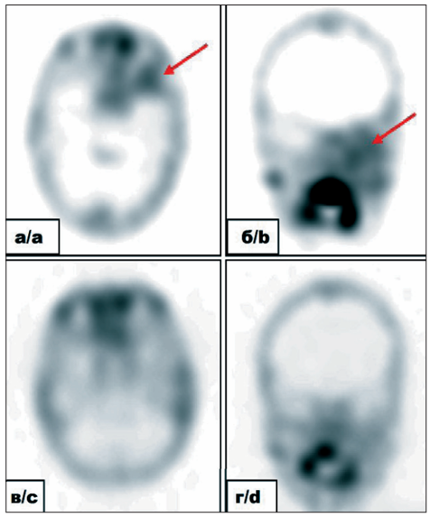 Изображение на обложке