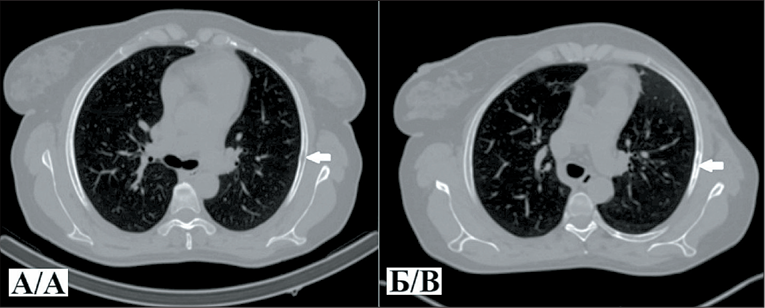 Изображение на обложке
